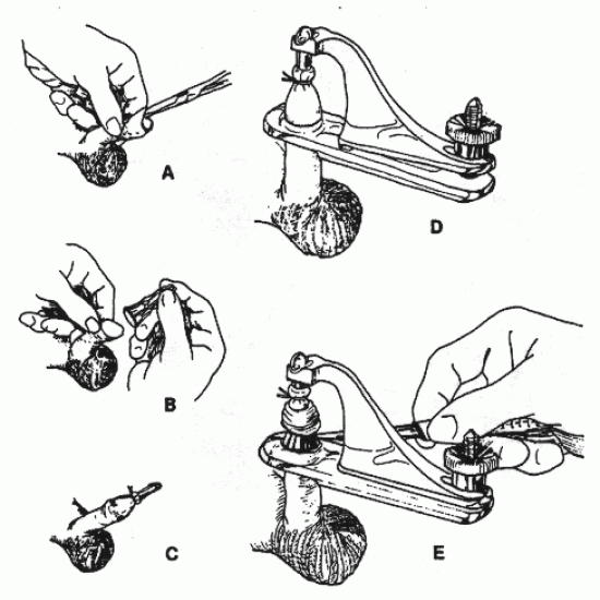 Circumcision Instruments 